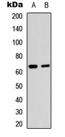 RELA / NFKB p65 Antibody - Western blot analysis of NF-kappaB p65 (AcK221) expression in HepG2 TSA-treated (A); mouse brain (B) whole cell lysates.