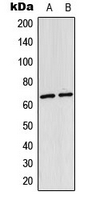 RELA / NFKB p65 Antibody - Western blot analysis of NF-kappaB p65 (AcK310) expression in HeLa (A); mouse lung (B) whole cell lysates.