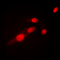 RELA / NFKB p65 Antibody - Immunofluorescent analysis of NF-kappaB p65 (AcK310) staining in HeLa cells. Formalin-fixed cells were permeabilized with 0.1% Triton X-100 in TBS for 5-10 minutes and blocked with 3% BSA-PBS for 30 minutes at room temperature. Cells were probed with the primary antibody in 3% BSA-PBS and incubated overnight at 4 C in a humidified chamber. Cells were washed with PBST and incubated with a DyLight 594-conjugated secondary antibody (red) in PBS at room temperature in the dark. DAPI was used to stain the cell nuclei (blue).