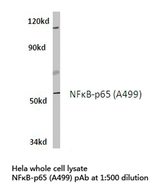 RELA / NFKB p65 Antibody - Western blot of NFB-p65 (A499) pAb in extracts from HeLa cells.