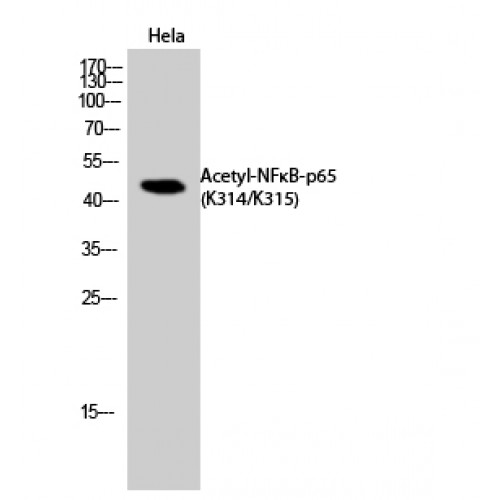 RELA / NFKB p65 Antibody - Western blot of Acetyl-NFkappaB-p65 (K314/K315) antibody