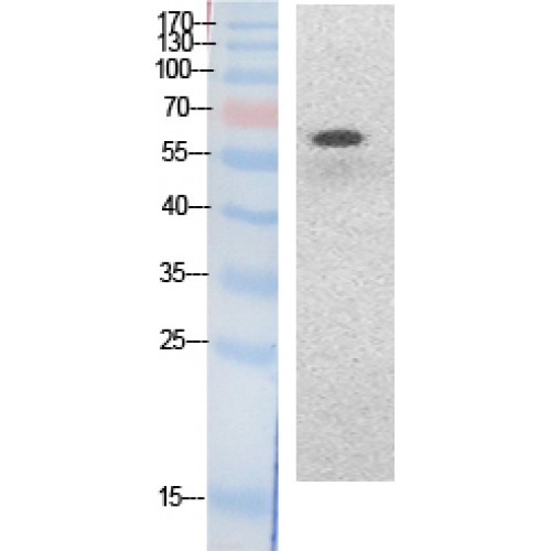 RELA / NFKB p65 Antibody - Western blot of Acetyl-NFkappaB-p65 (K314/K315) antibody