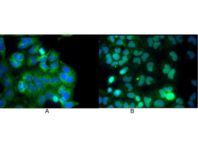 RELA / NFKB p65 Antibody - Monoclonal anti NFKB p65 (Rel A) antibody was used to detect p65 by immunofluorescence at a dilution of 1:5000. HeLa cells were grown to sub-confluent on 18 mm2 glass coverslips #1.5. Cells were either unstimulated (A), or stimulated (B) with 50 ng/ml of TNF alpha for 30 min prior fixation. Cells were then fixed in methanol and blocked with 10% normal goat serum (NGS), in PBS, and Triton X 0.2% (Tx) and incubated for 1 hr at RT with primary ab, counterstained with DAPI and washed in PBS/NGS/Tx. Cells were incubated for 1 hr at RT with Atto 425 conjugated anti mouse secondary antibody for STED CW imaging. Data was collected on a STED-CW TCS-SP5 Confocal system equipped with a DFC 350FX camera allowing sequential acquisition in wide field, confocal and STED CW imaging on the same system.