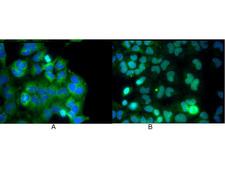 RELA / NFKB p65 Antibody - Monoclonal anti NFKB p65 (Rel A) antibody was used to detect p65 by immunofluorescence at a dilution of 1:5000. HeLa cells were grown to sub-confluent on 18 mm2 glass coverslips #1.5. Cells were either unstimulated (A), or stimulated (B) with 50 ng/ml of TNF alpha for 30 min prior fixation. Cells were then fixed in methanol and blocked with 10% normal goat serum (NGS), in PBS, and Triton X 0.2% (Tx) and incubated for 1 hr at RT with primary ab, counterstained with DAPI and washed in PBS/NGS/Tx. Cells were incubated for 1 hr at RT with Atto 425 conjugated anti mouse secondary antibody for STED CW imaging. Data was collected on a STED-CW TCS-SP5 Confocal system equipped with a DFC 350FX camera allowing sequential acquisition in wide field, confocal and STED CW imaging on the same system.