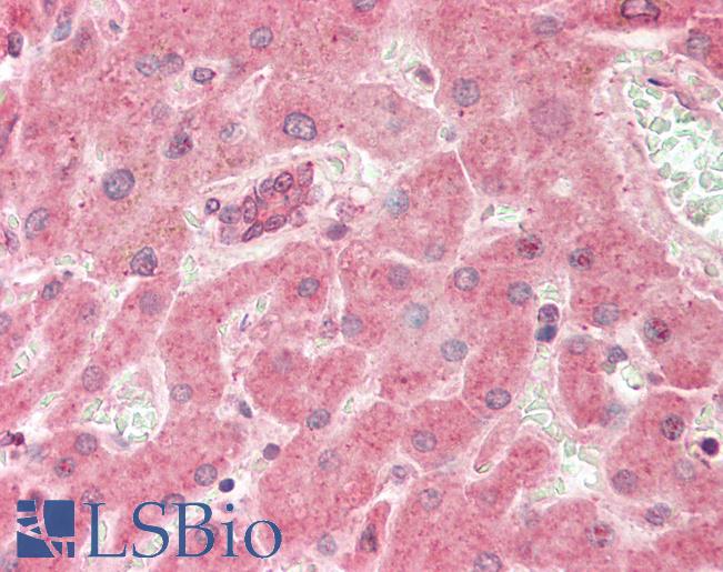 RELA / NFKB p65 Antibody - Human Liver: Formalin-Fixed, Paraffin-Embedded (FFPE).  This image was taken for the unconjugated form of this product. Other forms have not been tested.