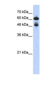 RELA / NFKB p65 Antibody - RELA antibody Western blot of Transfected 293T cell lysate. This image was taken for the unconjugated form of this product. Other forms have not been tested.
