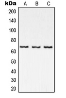 RELA / NFKB p65 Antibody - Western blot analysis of NF-kappaB p65 expression in DLD (A); mouse heart (B); rat brain (C) whole cell lysates.