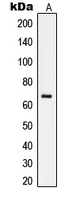 RELA / NFKB p65 Antibody - Western blot analysis of NF-kappaB p65 expression in HeLa (A) whole cell lysates.