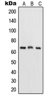 RELA / NFKB p65 Antibody - Western blot analysis of NF-kappaB p65 expression in HeLa (A); mouse kidney (B); rat kidney (C) whole cell lysates.
