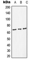 RELA / NFKB p65 Antibody - Western blot analysis of NF-kappaB p65 expression in HepG2 (A); HeLa (B); NIH3T3 (C) whole cell lysates.
