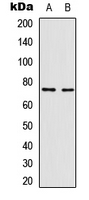 RELA / NFKB p65 Antibody - Western blot analysis of NF-kappaB p65 (pT435) expression in Jurkat TNFa-treated (A); HepG2 TNFa-treated (B) whole cell lysates.