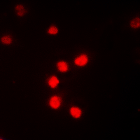 RELA / NFKB p65 Antibody - Immunofluorescent analysis of NF-kappaB p65 (pT435) staining in K562 cells. Formalin-fixed cells were permeabilized with 0.1% Triton X-100 in TBS for 5-10 minutes and blocked with 3% BSA-PBS for 30 minutes at room temperature. Cells were probed with the primary antibody in 3% BSA-PBS and incubated overnight at 4 deg C in a humidified chamber. Cells were washed with PBST and incubated with a DyLight 594-conjugated secondary antibody (red) in PBS at room temperature in the dark. DAPI was used to stain the cell nuclei (blue).