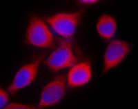 RELA / NFKB p65 Antibody - Hela cells stained with purified rabbit polyclonal antibody against NF-kappaB p65 (poly6226), followed by Rhodamine Red-X conjugated goat anti-rabbit IgG and DAPI