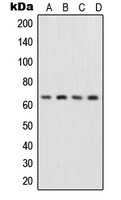 RELA / NFKB p65 Antibody - Western blot analysis of NF-kappaB p65 expression in HepG2 (A); MCF7 (B); Raw264.7 (C); rat liver (D) whole cell lysates.