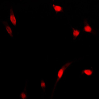 RELA / NFKB p65 Antibody - Immunofluorescent analysis of NF-kappaB p65 staining in MCF7 cells. Formalin-fixed cells were permeabilized with 0.1% Triton X-100 in TBS for 5-10 minutes and blocked with 3% BSA-PBS for 30 minutes at room temperature. Cells were probed with the primary antibody in 3% BSA-PBS and incubated overnight at 4 C in a humidified chamber. Cells were washed with PBST and incubated with a DyLight 594-conjugated secondary antibody (red) in PBS at room temperature in the dark. DAPI was used to stain the cell nuclei (blue).