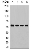 RELA / NFKB p65 Antibody - Western blot analysis of NF-kappaB p65 expression in HeLa (A); Raw264.7 (B); mouse liver (C); rat kidney (D) whole cell lysates.