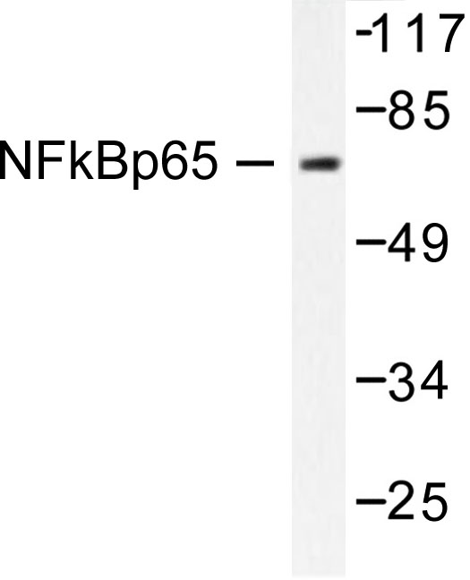 RELA / NFKB p65 Antibody - Western blot of NFB-p65 (L523) pAb in extracts from COS7 treated with Insulin 0.01U/ml 15'.