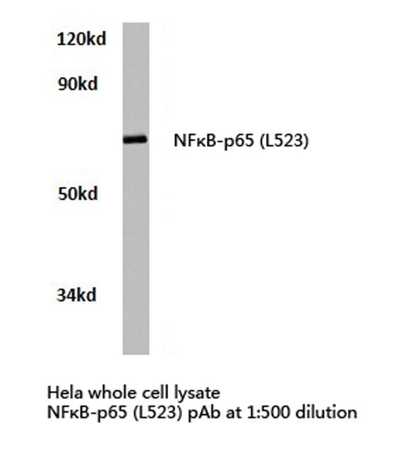 RELA / NFKB p65 Antibody - Western blot of NFB-p65 (L523) pAb in extracts from HeLa cells.