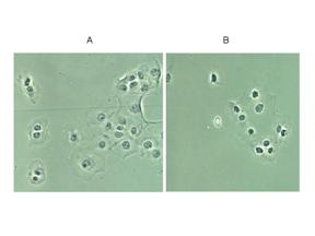 RELA / NFKB p65 Antibody - Anti-p65 NLS Antibody - Immunohistochemistry. Rabbit anti-p65 NLS was used at a 1:200 dilution to detect p65 in (A) control DU145 cells and (B) TNF stimulated DU145 cells. Although DU145 show relatively high basal levels of nuclear p65 staining, significant enhancement of nuclear staining is seen in panel B as evidence of translocation and availability of the NLS to be bound by the antibody. Cultured cells shown above were formalin-fixed. tissue staining (not shown) were formalin-fixed, paraffin embedded followed by citrate retrieval. Blocking and hybridization included 5% NGS.