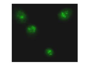 RELA / NFKB p65 Antibody - Anti-p65 NLS Antibody - Immunofluorescence Microscopy. Rabbit anti-p65 NLS was used at a 1:200 dilution to detect p65 in TNF stimulated DU145 cells. Image shown is at a 1:400 magnification. Tissue was fixed and prepared as above.