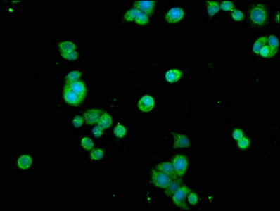 RELA / NFKB p65 Antibody - Immunofluorescence staining of PC-3 cells with RELA Antibody at 1:200, counter-stained with DAPI. The cells were fixed in 4% formaldehyde, permeabilized using 0.2% Triton X-100 and blocked in 10% normal Goat Serum. The cells were then incubated with the antibody overnight at 4°C. The secondary antibody was Alexa Fluor 488-congugated AffiniPure Goat Anti-Rabbit IgG(H+L).