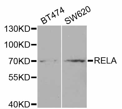 RELA / NFKB p65 Antibody - Western blot analysis of extracts of various cell lines.