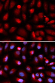 RELA / NFKB p65 Antibody - Immunofluorescence analysis of U2OS cells.