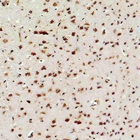 RELA / NFKB p65 Antibody - Immunohistochemical analysis of NF-kappaB p65 staining in rat brain formalin fixed paraffin embedded tissue section. The section was pre-treated using heat mediated antigen retrieval with sodium citrate buffer (pH 6.0). The section was then incubated with the antibody at room temperature and detected using an HRP conjugated compact polymer system. DAB was used as the chromogen. The section was then counterstained with hematoxylin and mounted with DPX.