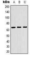 RELA / NFKB p65 Antibody - Western blot analysis of NF-kappaB p65 expression in HeLa (A); 293T (B); HepG (C) whole cell lysates.