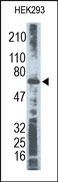 RELA / NFKB p65 Antibody - The NFKB p65 Antibody is used in Western blot to detect NFKB p65 in HEK293 cell lysate.