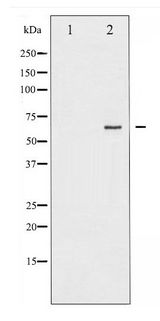 RELA / NFKB p65 Antibody - Western blot of NF-kappaB p65 expression in HeLa whole cell lysates,The lane on the left is treated with the antigen-specific peptide.