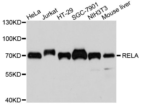 RELA / NFKB p65 Antibody - Western blot analysis of extracts of various cell lines, using RELA antibody at 1:1000 dilution. The secondary antibody used was an HRP Goat Anti-Mouse IgG (H+L) at 1:10000 dilution. Lysates were loaded 25ug per lane and 3% nonfat dry milk in TBST was used for blocking. An ECL Kit was used for detection and the exposure time was 90s.