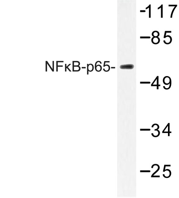 RELA / NFKB p65 Antibody - Western blot of NFB-p65 (K303) pAb in extracts from COS cells treated with sorbitol 0.4M 24h.