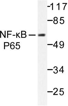 RELA / NFKB p65 Antibody - Western blot of NFB-p65 (M270) pAb in extracts from HeLa cells.