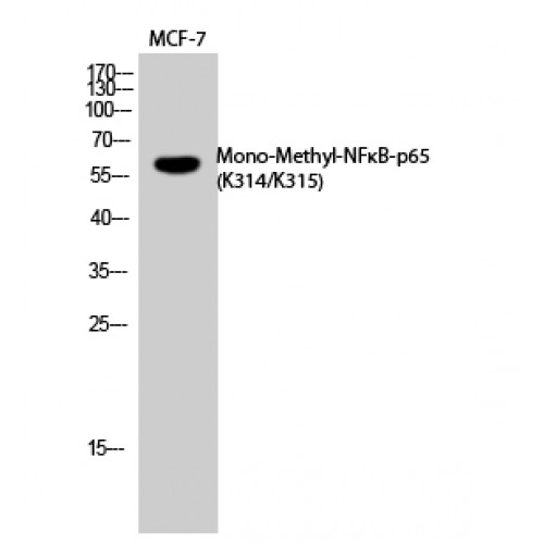 RELA / NFKB p65 Antibody - Western blot of Mono-Methyl-NFkappaB-p65 (K314/K315) antibody