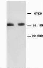 RELA / NFKB p65 Antibody