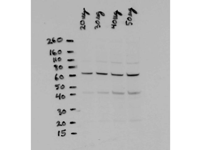 RELA / NFKB p65 Antibody - Western Blot of Rabbit anti-NFKB p65 N term antibody. Lane 1-4: PC3 cell lysate. Load: 20, 30, 40, and 50 ug per lane. Primary antibody: NFKB p65 antibody at 1:5000 for overnight at 4°C. Secondary antibody: HRP rabbit secondary antibody at 1:10,000 for 45 min at RT.