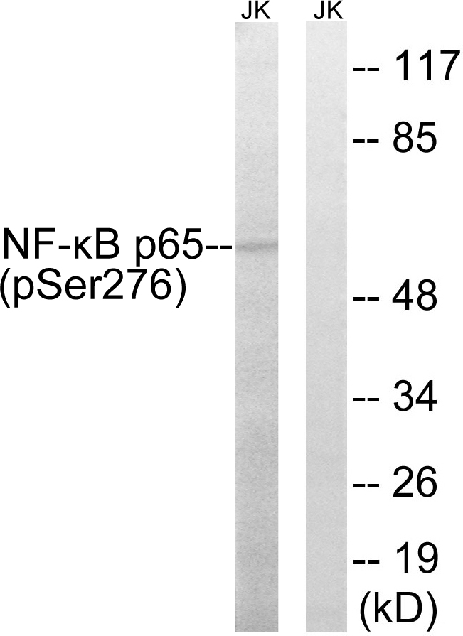 RELA / NFKB p65 Antibody - Western blot analysis of lysates from Jurkat cells, using NF-kappaB p65 (Phospho-Ser276) Antibody. The lane on the right is blocked with the phospho peptide.