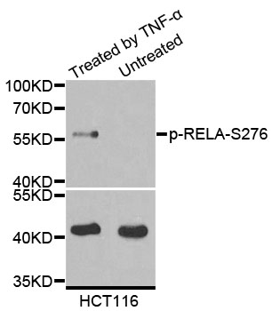RELA / NFKB p65 Antibody - Western blot analysis of extracts of various cell lines.
