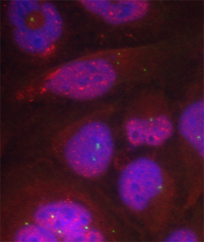 RELA / NFKB p65 Antibody - Immunofluorescence staining of methanol-fixed HeLa cells.