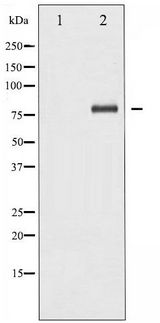 RELA / NFKB p65 Antibody - Western blot of NF- kappaB p65 phosphorylation expression in HeLa whole cell lysates,The lane on the left is treated with the antigen-specific peptide.