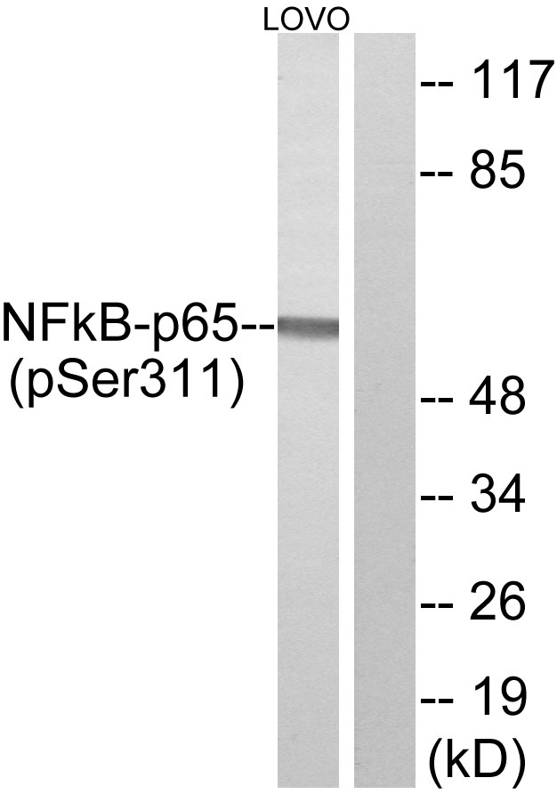 RELA / NFKB p65 Antibody - Western blot analysis of lysates from LOVO cells treated, using NF-kappaB p65 (Phospho-Ser311) Antibody. The lane on the right is blocked with the phospho peptide.