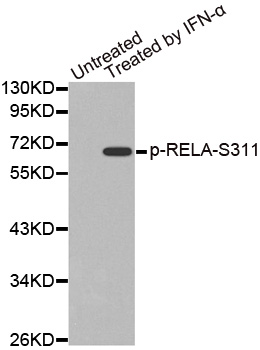 RELA / NFKB p65 Antibody - Western blot analysis of extracts from Hela cells.