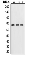 RELA / NFKB p65 Antibody - Western blot analysis of NF-kappaB p65 (pS311) expression in HeLa TNFa-treated (A); mouse kidney (B); PC12 UV-treated (C) whole cell lysates.