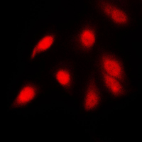 RELA / NFKB p65 Antibody - Immunofluorescent analysis of NF-kappaB p65 (pS311) staining in PC12 cells. Formalin-fixed cells were permeabilized with 0.1% Triton X-100 in TBS for 5-10 minutes and blocked with 3% BSA-PBS for 30 minutes at room temperature. Cells were probed with the primary antibody in 3% BSA-PBS and incubated overnight at 4 C in a humidified chamber. Cells were washed with PBST and incubated with a DyLight 594-conjugated secondary antibody (red) in PBS at room temperature in the dark. DAPI was used to stain the cell nuclei (blue).