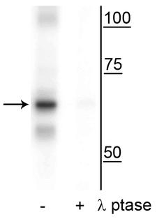 RELA / NFKB p65 Antibody - Western blot of 20’ UV treated HeLa lysate showing specific immunolabeling of the ~65 kDa NF-?B p65 phosphorylated at Ser316 in the first lane (-). Phosphospecificity is shown in the second lane (+) where immunolabeling is eliminated by blot treatment with lambda phosphatase (lambda-Ptase, 1200 units for 30 min).