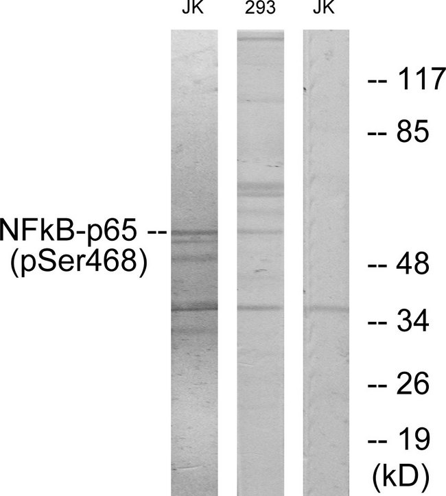 RELA / NFKB p65 Antibody - Western blot analysis of lysates from Jurkat cells and 293 cells, using NF-kappaB p65 (Phospho-Ser468) Antibody. The lane on the right is blocked with the phospho peptide.