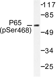 RELA / NFKB p65 Antibody - Western blot of p-NFB-p65 (S468) pAb in extracts from HeLa cells.