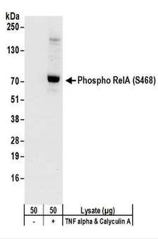 RELA / NFKB p65 Antibody - Detection of Human Phospho RelA (S468) by Western Blot. Samples: Whole cell lysate (50 ug) from Jurkat cells treated with TNF alpha and Calyculin A (+) or mock treated (-). Antibodies: Affinity purified rabbit anti-Phospho RelA (S468) antibody used for WB at 0.1 ug/ml. Detection: Chemiluminescence with an exposure time of 10 seconds.