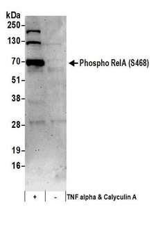 RELA / NFKB p65 Antibody - Detection of human Phospho RelA (S468) by western blot. Samples: Whole cell lysate (50 µg) from Jurkat cells treated with TNF alpha and Calyculin A (+) or mock treated (-). Antibodies: Affinity purified rabbit anti-Phospho RelA (S468) antibody used for WB at 0.1 µg/ml. Detection: Chemiluminescence with an exposure time of 10 seconds.